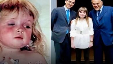 الطبيب المصري مجدي يعقوب يعيد قلب فتاة للحياة بعد توقفه 10 سنوات