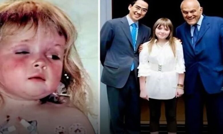 الطبيب المصري مجدي يعقوب يعيد قلب فتاة للحياة بعد توقفه 10 سنوات