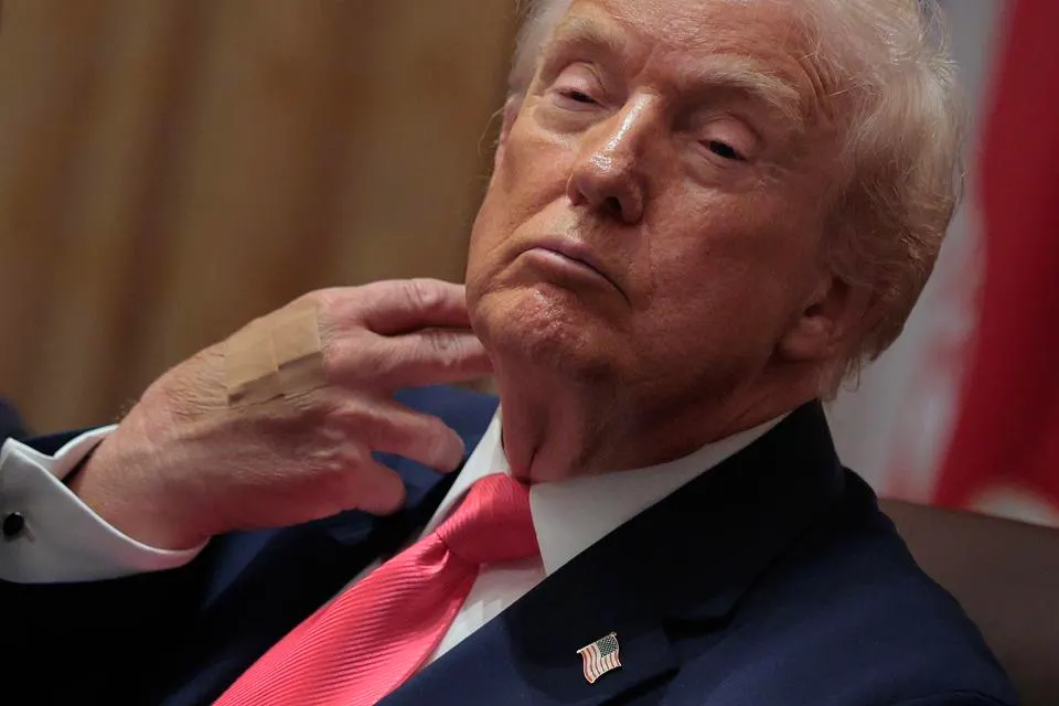 ترامب يشارك بتوقيع اتفاقية سلام بين الكونغو الديمقراطية ورواندا مع ضمادة على معصمه