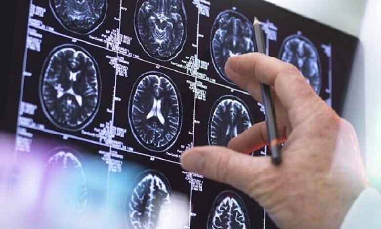 اكتشاف مركّب جديد يثبط جينات مرتبطة بأشد أورام الدماغ عدوانية في روسيا 1 اكتشاف مركّب جديد يثبط جينات مرتبطة بأشد أورام الدماغ عدوانية في روسيا