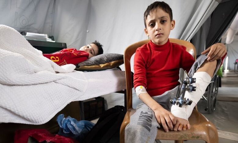 وزارة الصحة الفلسطينية في غزة: في اليوم العالمي للإعاقة، أوضاع صادمة تعصف بالجرحى مبتوري الأطراف في قطاع غزة 1 وزارة الصحة الفلسطينية في غزة: في اليوم العالمي للإعاقة، أوضاع صادمة تعصف بالجرحى مبتوري الأطراف في قطاع غزة