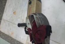 في واقعة نادرة.. فريق طبي مصري ينقذ حياة طفل ويستخرج منشارا كهربائيا اخترق بطنه