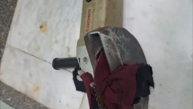 في واقعة نادرة.. فريق طبي مصري ينقذ حياة طفل ويستخرج منشارا كهربائيا اخترق بطنه