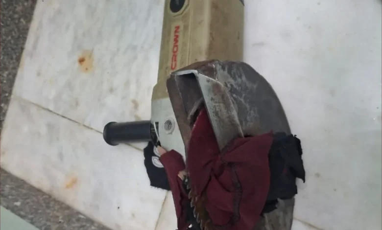 في واقعة نادرة.. فريق طبي مصري ينقذ حياة طفل ويستخرج منشارا كهربائيا اخترق بطنه 1 في واقعة نادرة.. فريق طبي مصري ينقذ حياة طفل ويستخرج منشارا كهربائيا اخترق بطنه